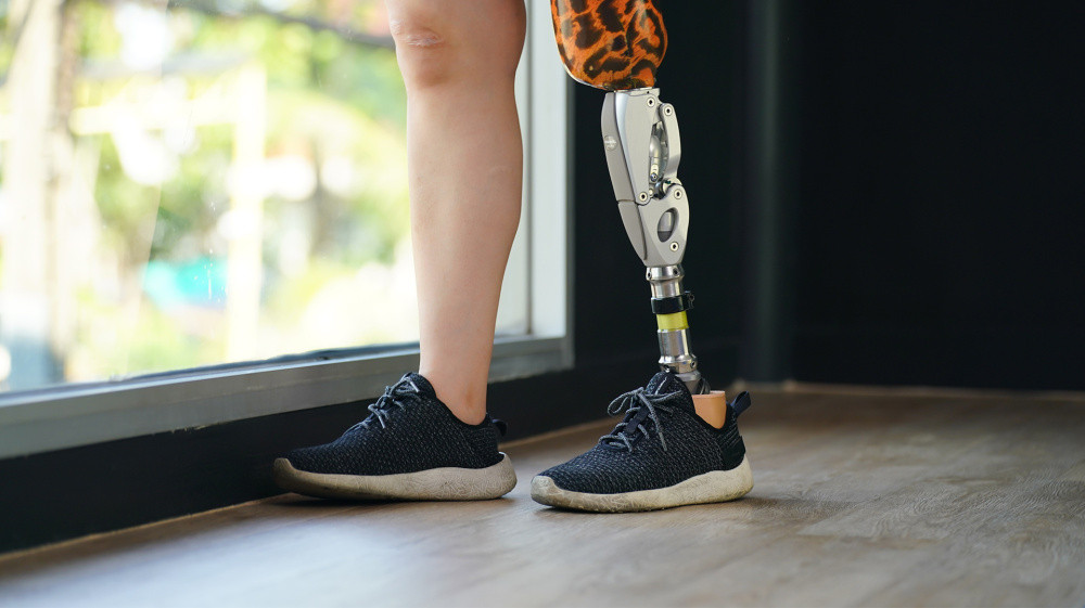 Understanding the Types of Injuries Covered in Serious Injury Claims