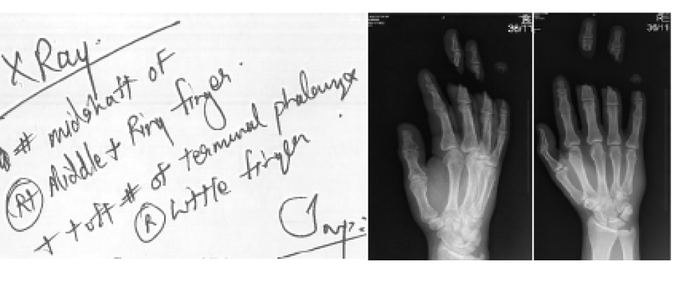 Work accident